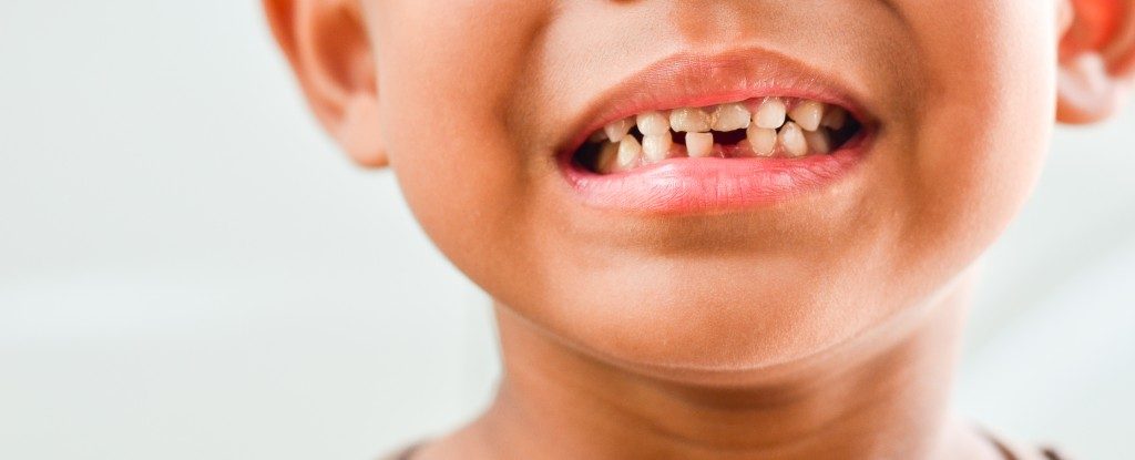 kid's teeth