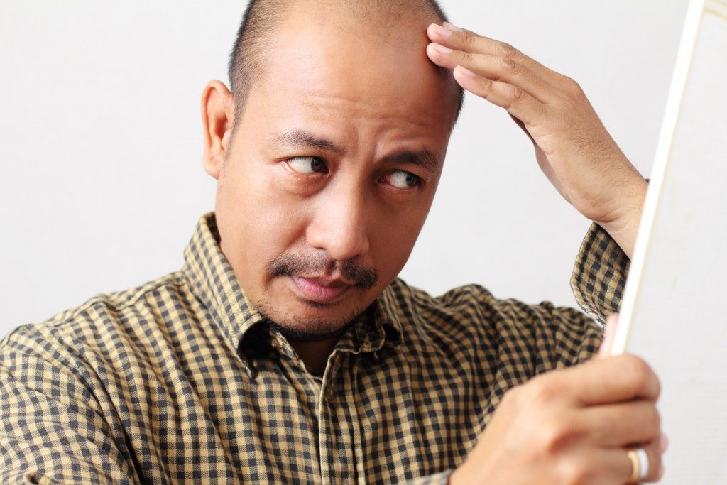 man checking his balding head