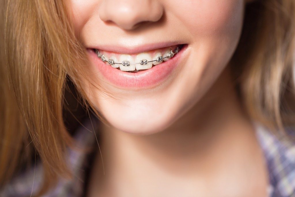 Woman with braces smiling