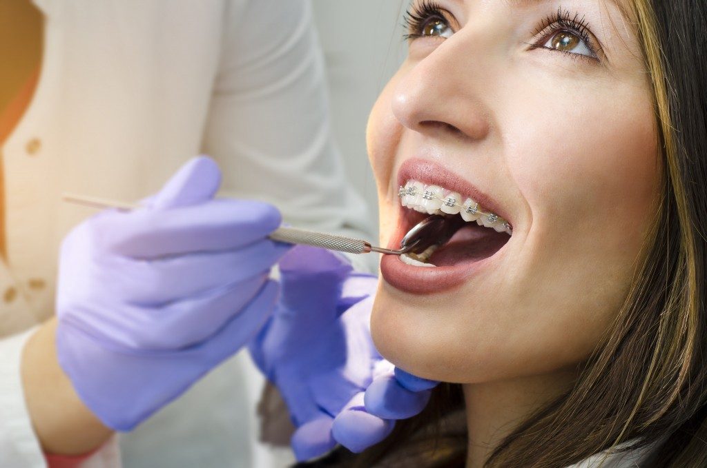 Closeup of a woman having her oral check up while wearing braces