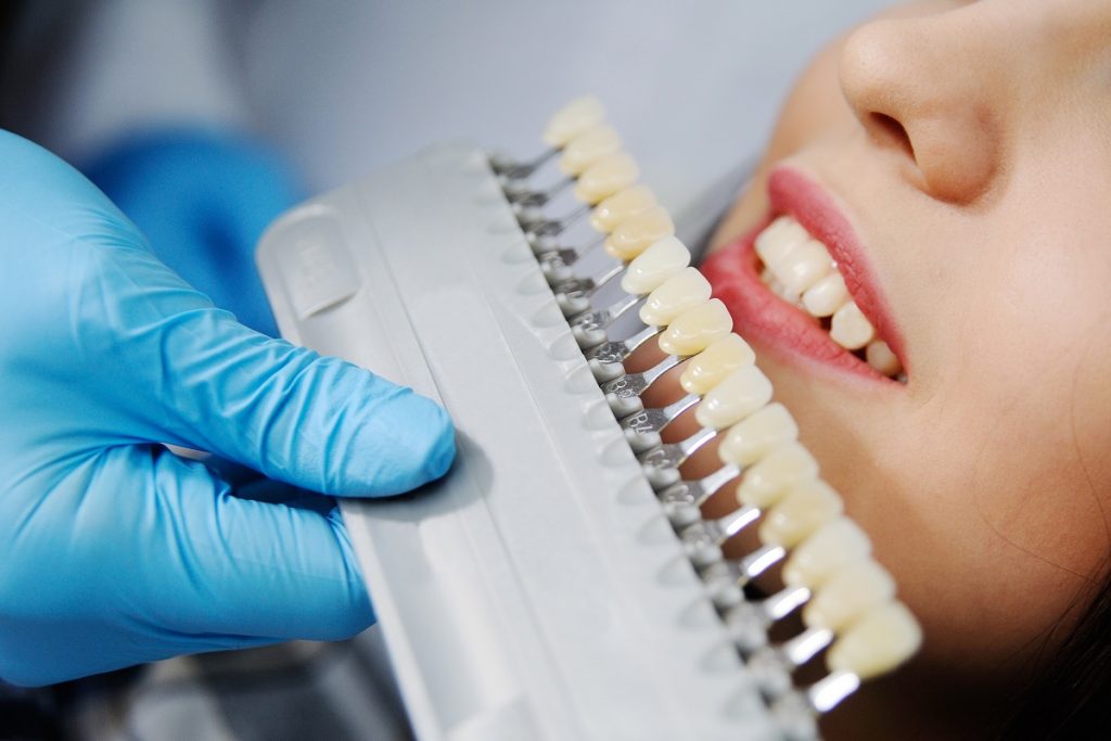 Dentist comparing teeth color