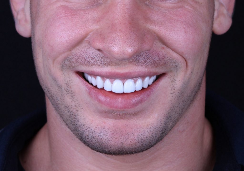 man with white teeth