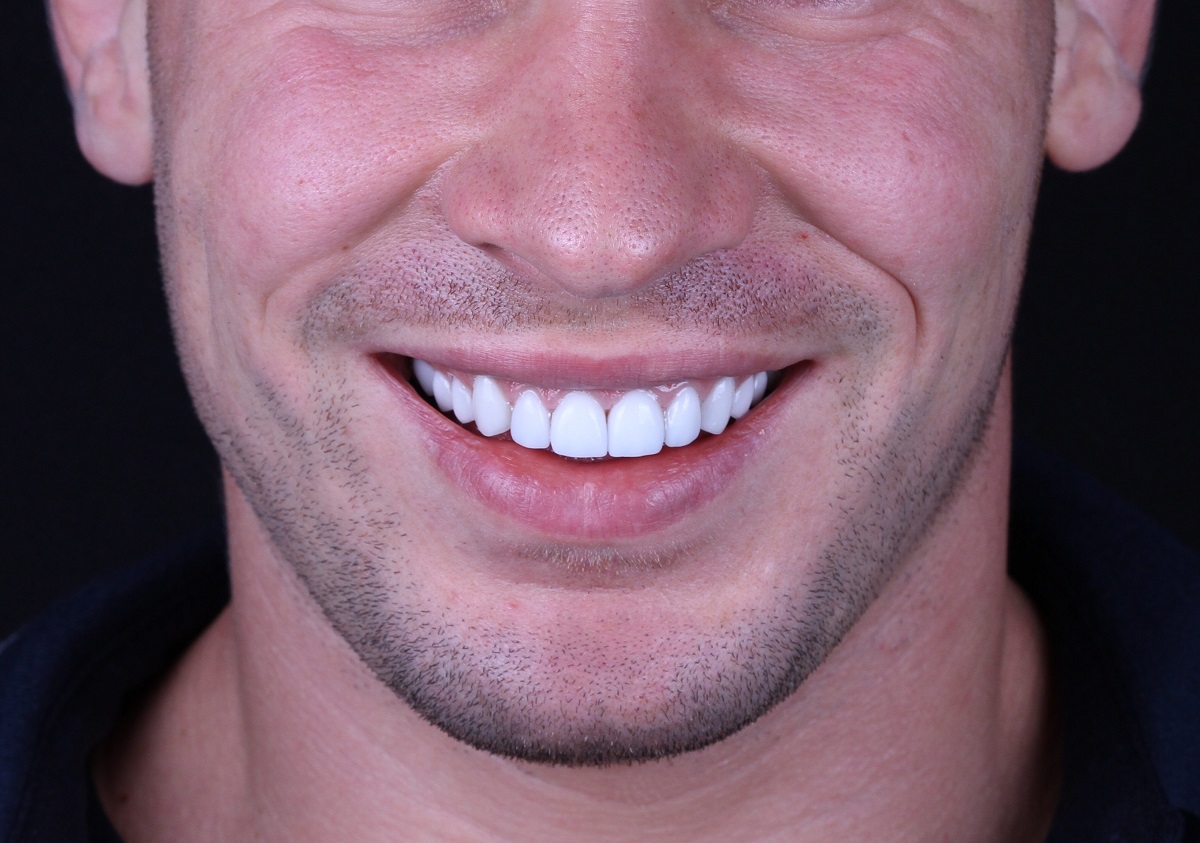 Белоснежные зубы мужчины