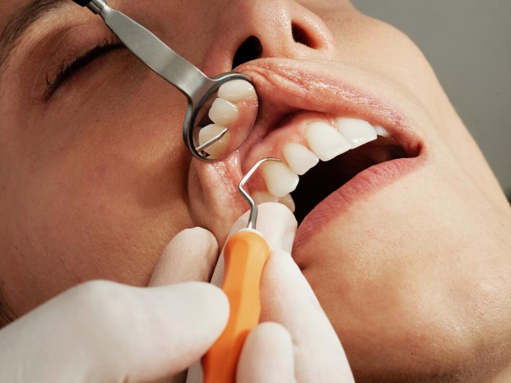 checking gums of a patient