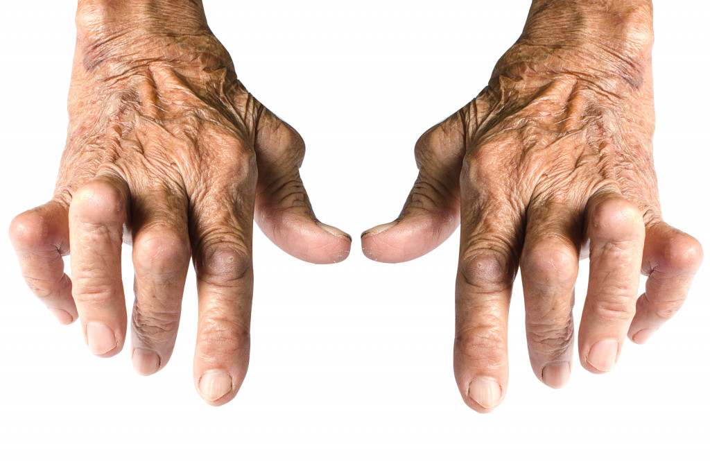 Arthritis in man